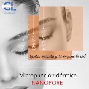 tratamiento con nanopore